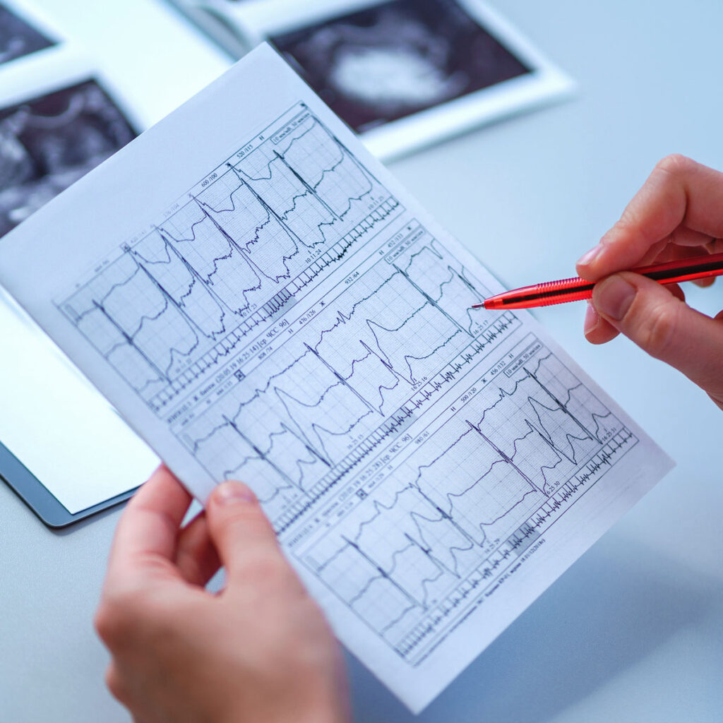 Examines electrocardiogram of patient during a health check and medical consultation